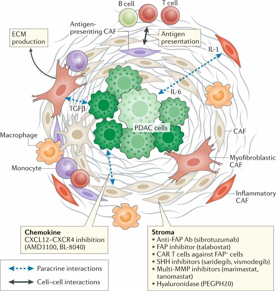 Diagram of PDAC tumor microenvironment showing cancer cells surrounded by cancer-associated fibroblasts, stromal matrix, immunosuppressive macrophages, monocytes, and paracrine signaling barriers including TGF-beta and IL-6