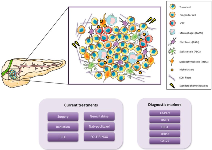 iagram of pancreatic tumor ecosystem showing cancer cells surrounded by cancer-associated fibroblasts, tumor-associated macrophages, stellate cells, mesenchymal cells, ECM fibers, and niche factors with current treatment options including surgery, gemcitabine, nab-paclitaxel and FOLFIRINOX